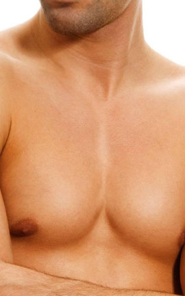 Male Tuberous Breast, Plastic Surgery