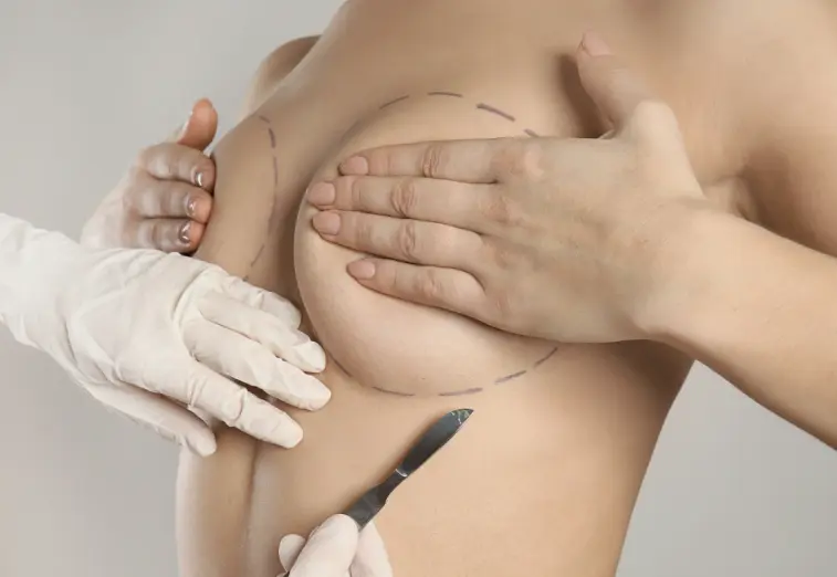Breast Augmentation vs Implants: WhatÔÇÖs the Difference?