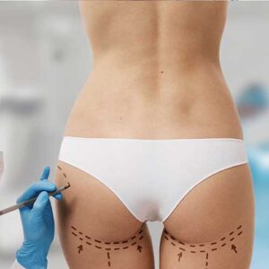 butt augmentation page