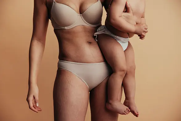 Mommy Makeover