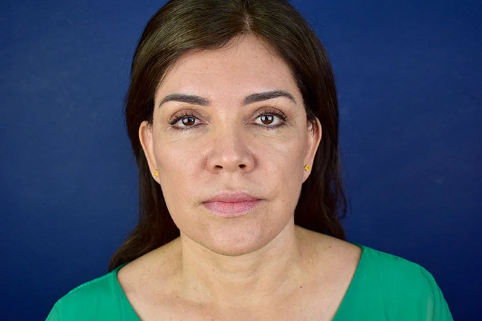 LEONELA 2 M DESP2 1