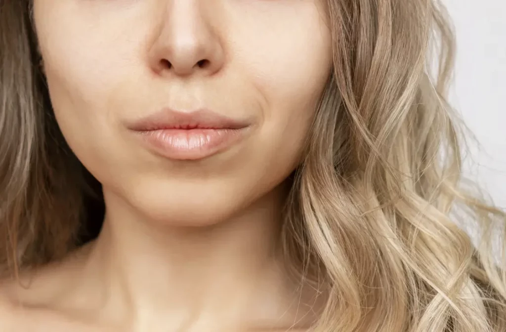 What Is Buccal Fat Removal