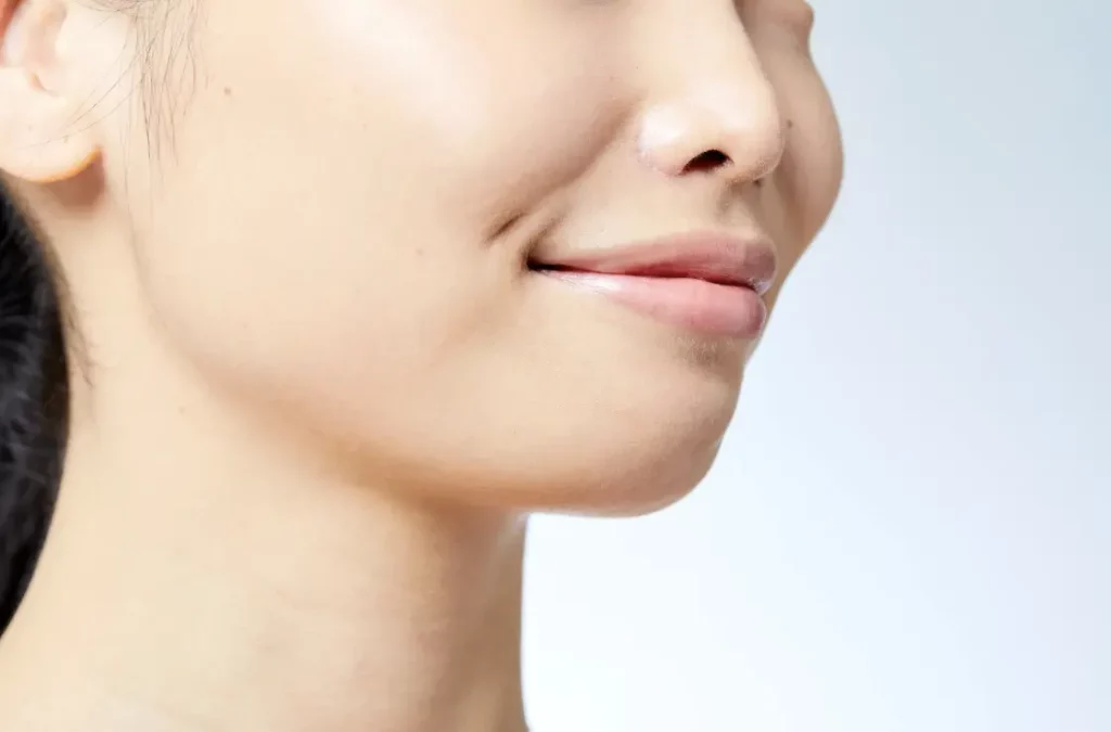 Buccal Fat Removal Cost